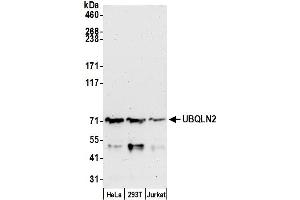 anti-Ubiquilin 2 (UBQLN2) (AA 1-50) antibody