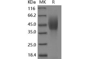 Western Blotting (WB) image for Niemann-Pick Disease, Type C1 (NPC1) protein (His tag,DYKDDDDK Tag) (ABIN7317151) (NPC1 Protein (His tag,DYKDDDDK Tag))