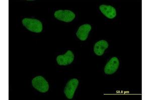 Immunofluorescence of purified MaxPab antibody to DFFA on HeLa cell. (DFFA antibody  (AA 1-331))