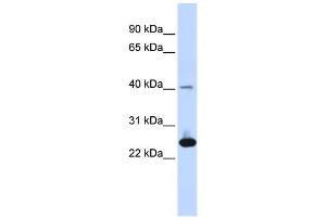 WB Suggested Anti-SELS Antibody Titration: 0. (Selenoprotein S antibody  (Middle Region))
