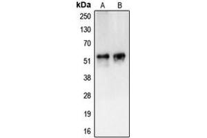 Western blot analysis of CAMKV expression in HL60 (A), HuvEc (B) whole cell lysates.