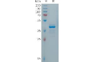 Human CALCA(26-141) Protein, hFc Tag on SDS-PAGE under reducing condition.