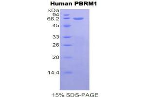 SDS-PAGE analysis of Human Polybromo 1 Protein.