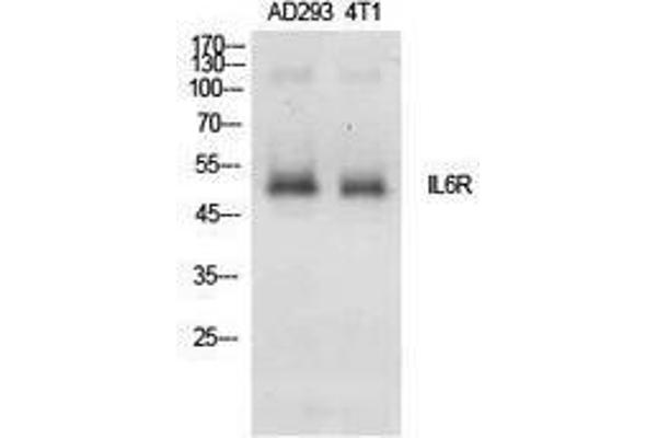 IL6RA antibody  (Internal Region)