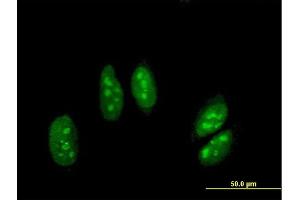 Immunofluorescence (IF) image for anti-Adenosine Deaminase, RNA-Specific, B1 (ADARB1) (AA 1-741) antibody (ABIN513114)
