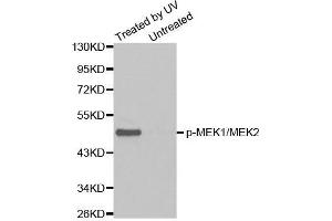 Western blot analysis of extracts from Hela cell untreated or treated with UV using Phospho-MAP2K1/MAP2K2-S217/S221 antibody (MEK1 antibody  (pSer221, Ser217, Ser221))