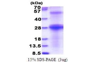 SDS-PAGE (SDS) image for Hepatitis C Virus Envelope Protein E2 (HCV E2) (AA 482-671) protein (His tag) (ABIN5853806)