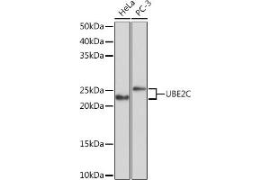 Western blot analysis of extracts of various cell lines, using UBE2C Rabbit mAb (ABIN1680590, ABIN3019392, ABIN3019393 and ABIN7101768) at 1:1000 dilution. (UBE2C antibody)