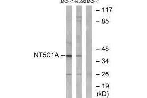 Western blot analysis of extracts from MCF-7 cells and HepG2 cells, using NT5C1A antibody. (NT5C1A antibody)
