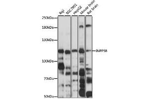 Western blot analysis of extracts of various cell lines, using INPP5B antibody (ABIN6292588) at 1:3000 dilution.