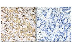 Immunohistochemistry (IHC) image for anti-Fucosyltransferase 3 (Galactoside 3(4)-L-Fucosyltransferase, Lewis Blood Group) (FUT3) (Internal Region) antibody (ABIN1851348) (FUT3 antibody  (Internal Region))