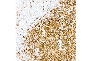 Immunohistochemistry (IHC) image for anti-HLA-DR (HLA-DR) antibody (ABIN7449537) (HLA-DR antibody)
