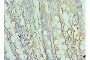 Immunohistochemistry of paraffin-embedded human colon tissue using ABIN7170676 at dilution of 1:100 (SRPK1 antibody  (AA 290-480))