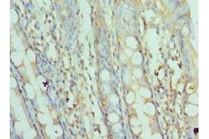 Immunohistochemistry of paraffin-embedded human colon tissue using ABIN7170676 at dilution of 1:100 (SRPK1 antibody  (AA 290-480))