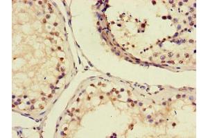 Immunohistochemistry of paraffin-embedded human testis tissue using ABIN7156703 at dilution of 1:100 (AIM2 antibody  (AA 81-326))