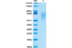Cynomolgus B7-2 on Tris-Bis PAGE under reduced condition. (CD86 Protein (CD86) (AA 26-240) (His tag))