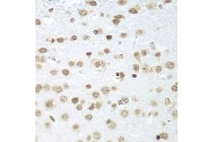 Immunohistochemistry of paraffin-embedded mouse brain using S antibody (ABIN1682621, ABIN3018891, ABIN3018892 and ABIN6220612) at dilution of 1:100 (40x lens). (SAP18 antibody  (AA 21-172))