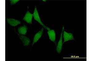 Immunofluorescence of monoclonal antibody to SMAD7 on HeLa cell. (SMAD7 antibody  (AA 302-400))