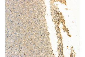 ABIN7094515 and ABIN7098564 at 1/100 staining Rat brain tissue by IHC-P. (LINGO1 antibody  (C-Term))