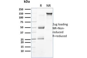 SDS-PAGE (SDS) image for anti-Keratin 18 (KRT18) antibody (ABIN6939932)