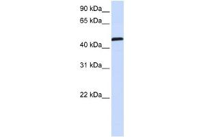 UMPS antibody used at 1 ug/ml to detect target protein. (UMPS antibody  (C-Term))