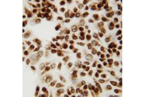 Anti-CTBP2 antibody, ICC ICC: HELA Cell (CTBP2 antibody  (C-Term))