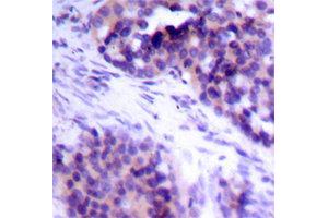 Immunohistochemistry (IHC) image for anti-BCL2-Like 1 (BCL2L1) (pSer62) antibody (ABIN1870015) (BCL2L1 antibody  (pSer62))