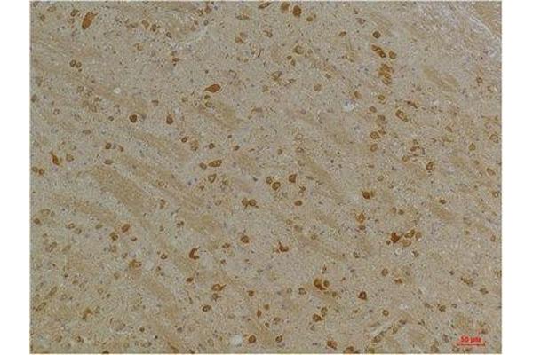 KCNH5 antibody