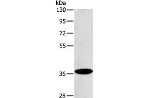 Western Blot analysis of Raji cell using ACMSD Polyclonal Antibody at dilution of 1:400 (ACMSD antibody)
