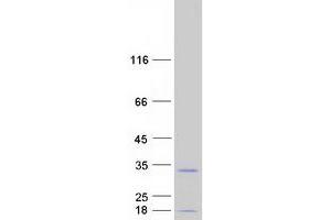 DIRAS2 Protein (Myc-DYKDDDDK Tag)