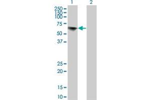 Western Blot analysis of TOE1 expression in transfected 293T cell line by TOE1 monoclonal antibody (M02), clone 1C12.