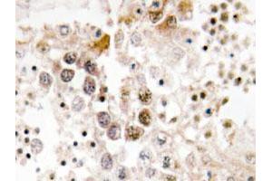 Immunohistochemical analysis of paraffin-embedded human testis tissue using FOXL1 polyclonal antibody . (FOXL1 antibody)