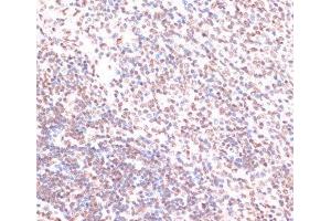 Immunohistochemistry (Paraffin-embedded Sections) (IHC (p)) image for anti-Mitogen-Activated Protein Kinase 3 (MAPK3) (pThr185), (pThr202), (pTyr187), (pTyr204) antibody (ABIN7265214)