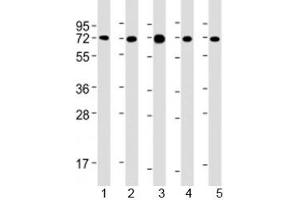 Western blot testing of human 1) MCF-7, 2) PC-3, 3) COS-7, 4) DU-145 and 5) SK-BR-3 cell lysate with USP2 antibody at 1:2000.