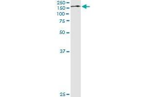 Western Blotting (WB) image for anti-Tripartite Motif Containing 24 (TRIM24) (AA 432-569) antibody (ABIN599067) (TRIM24 antibody  (AA 432-569))