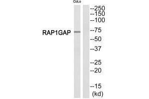 Western blot analysis of extracts from COLO205 cells, using RAP1GDS1 antibody.