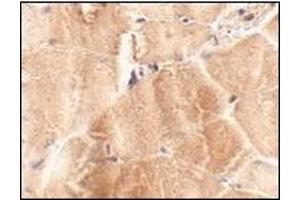 Immunohistochemistry of JPH2 in mouse skeletal muscle tissue with this product at 2. (Junctophilin 2 antibody  (C-Term))