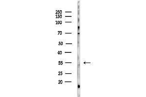 anti-Tumor Necrosis Factor, alpha-Induced Protein 1 (Endothelial) (TNFAIP1) (Internal Region) antibody