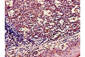 Immunohistochemistry of paraffin-embedded human tonsil tissue using ABIN7166304 at dilution of 1:100 (WNT5A antibody  (AA 62-380))