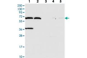 Western blot analysis of Lane 1: RT-4, Lane 2: U-251 MG, Lane 3: Human Plasma, Lane 4: Liver, Lane 5: Tonsil with ADAMTSL5 polyclonal antibody . (ADAMTS-Like 5 antibody)