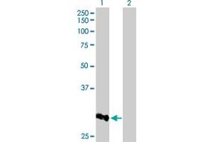 Western Blot analysis of CCNB1IP1 expression in transfected 293T cell line by CCNB1IP1 MaxPab polyclonal antibody. (CCNB1IP1 antibody  (AA 1-277))