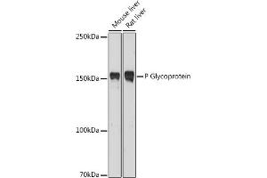 Western blot analysis of extracts of various cell lines, using P Glycoprotein antibody (ABIN6134228, ABIN6136339, ABIN6136342 and ABIN6215442) at 1:1000 dilution. (ABCB1 antibody  (AA 600-700))