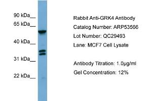 WB Suggested Anti-GRK4  Antibody Titration: 0. (GRK4 antibody  (Middle Region))