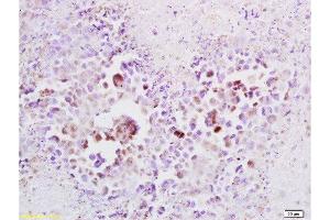 Formalin-fixed and paraffin embedded mouse lymphoma tissue labeled with Anti-Cyclin A2 Polyclonal Antibody , Unconjugated at 1:100, followed by conjugation to the secondary antibody and DAB staining (Cyclin A antibody  (AA 375-431))