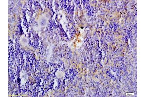 Formalin-fixed and paraffin embedded rat spleen tissue labeled with Anti-5-HTT/SLC6A4 Polyclonal Antibody, Unconjugated (ABIN735983) at 1:200 followed by conjugation to the secondary antibody and DAB staining