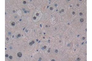Immunohistochemistry (IHC) image for anti-Choline O-Acetyltransferase (CHAT) (AA 517-732) antibody (ABIN7440704)