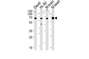 Western Blotting (WB) image for anti-Protein Kinase C and Casein Kinase Substrate in Neurons 2 (PACSIN2) antibody (ABIN3003675) (PACSIN2 antibody)