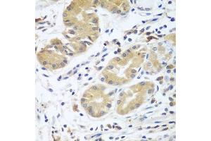 Immunohistochemistry of paraffin-embedded human stomach using CFD antibody. (Adipsin antibody  (AA 26-253))