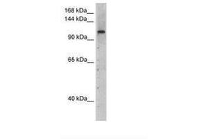 Image no. 1 for anti-PRP6 Pre-mRNA Processing Factor 6 Homolog (PRPF6) (AA 51-100) antibody (ABIN204965) (PRP6/ANT-1 antibody  (AA 51-100))