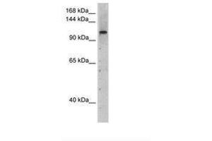 Image no. 1 for anti-PRP6 Pre-mRNA Processing Factor 6 Homolog (PRPF6) (AA 51-100) antibody (ABIN204965)
